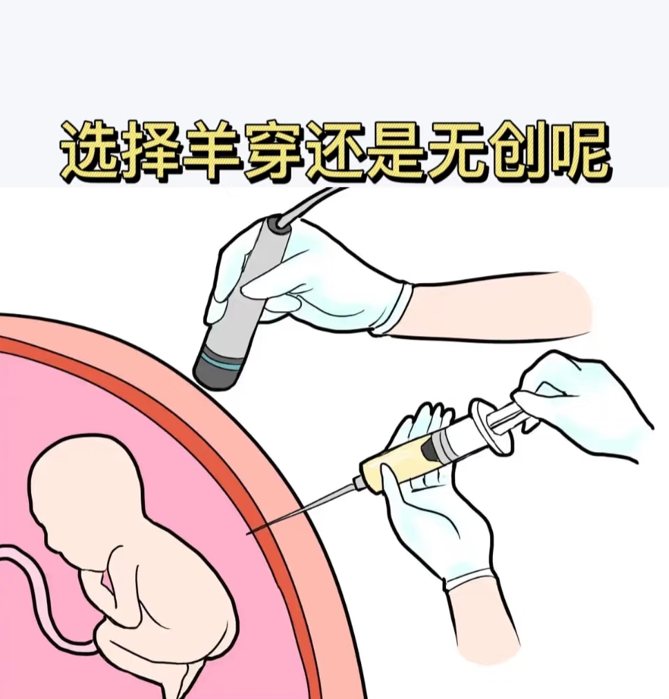 NIPT vs 羊水穿刺：读懂产前检查的“筛查”与“诊断”